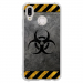 TPU0P20LITERADIOACTIF - Coque souple pour Huawei P20 Lite avec impression Motifs radioactif